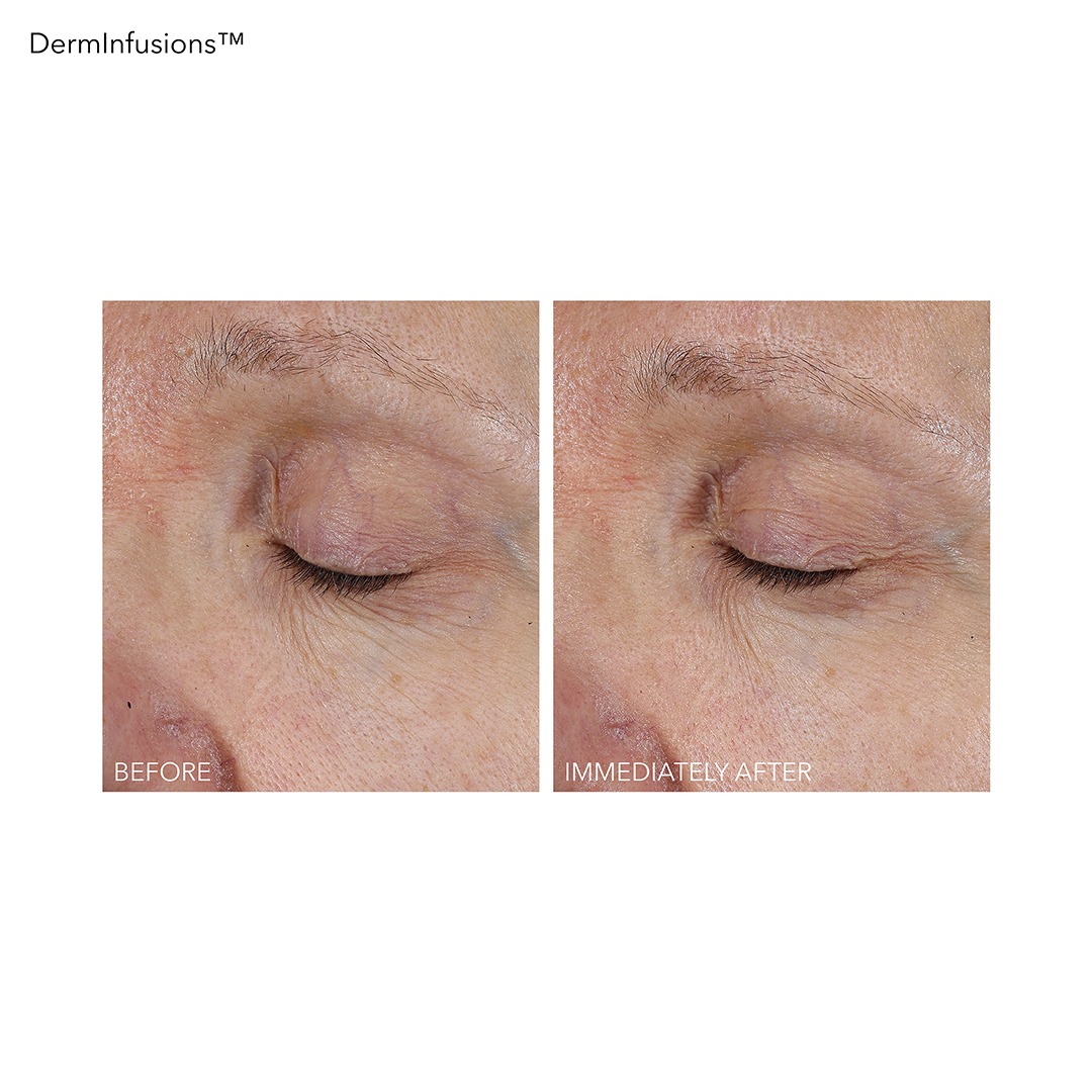 DDG_DERMINFUSIONS_Lift&Repair_Eye_Mask_B&A