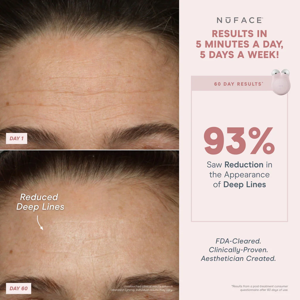 NF_MINI_PDP_Benefits-BA-93_1x1_439dec3e-a5c2-4302-a255-adf97a4c9139