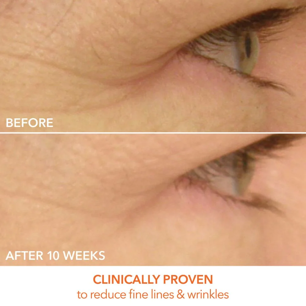 Instagramcrop1to1-Eyecare_Max_Pro_PPage_Assets_R32_681e5bdc-03a0-4b00-9b9b-5917eb3ff97b_5000x