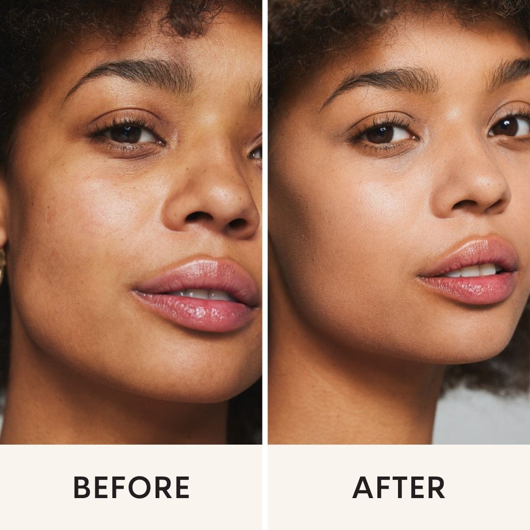 Before & After template - eyebright 003