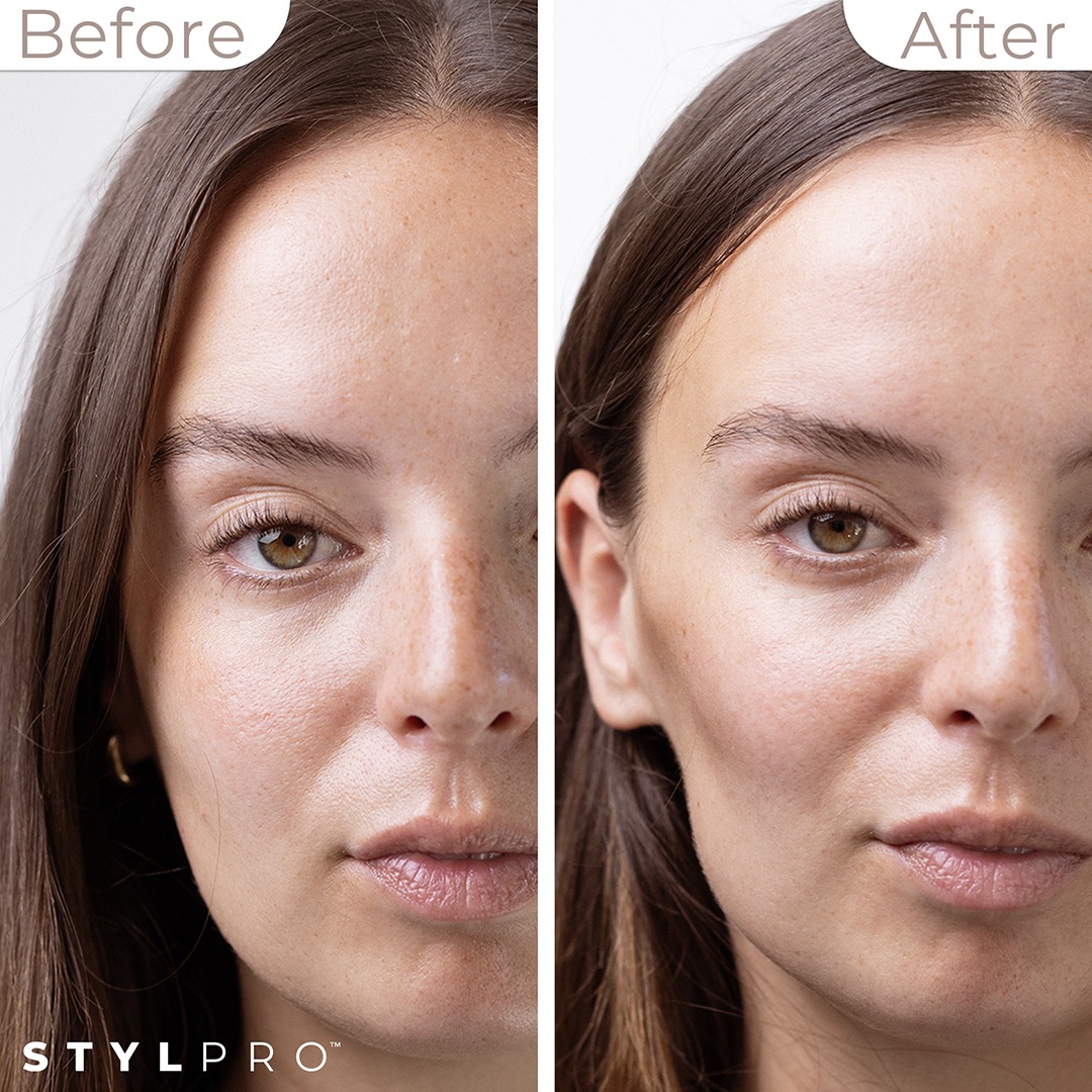 MC01A - BEFORE & AFTER CLOSE UP