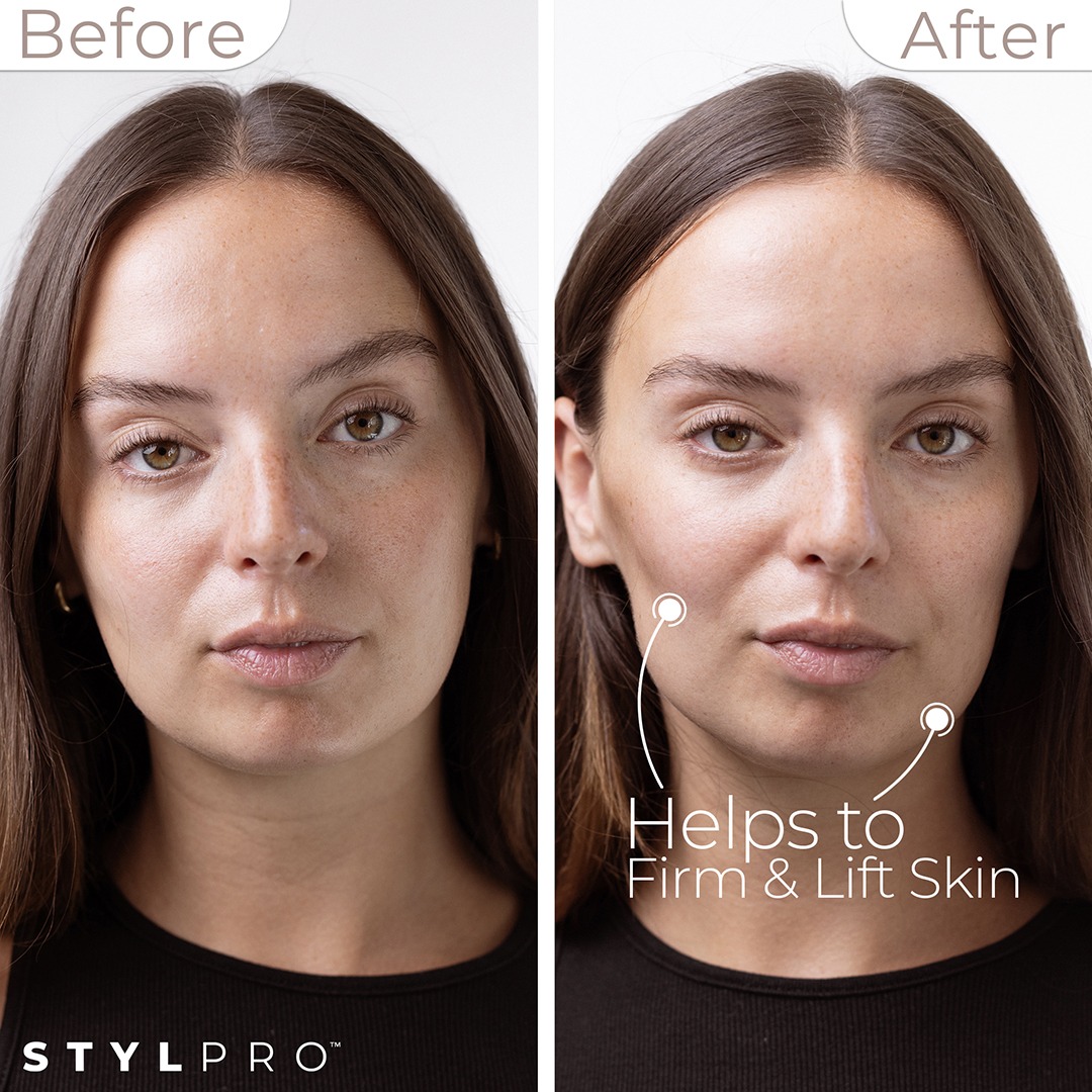 MC01A - BEFORE & AFTER TEXT