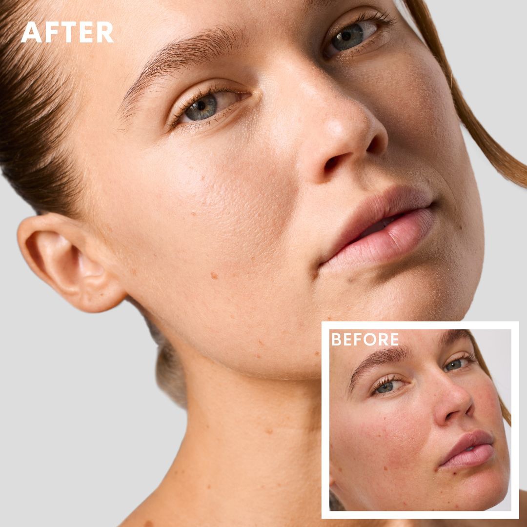 Before & After template  - 2