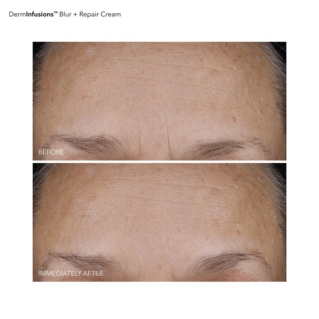 DermInfusions_BlurRepairCream_BAs_R1