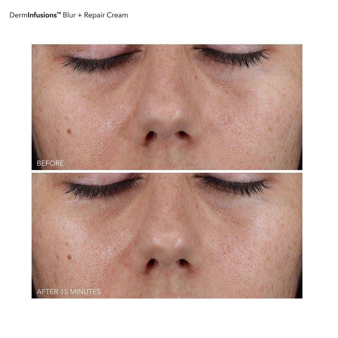 DermInfusions_BlurRepairCream_BAs_R13