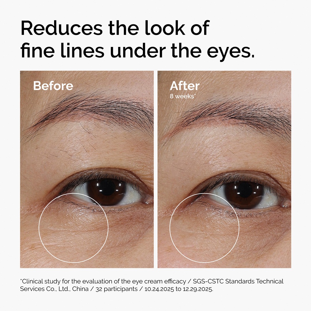 The Ordinary - Lacto-PDRN* 4% +B9 Eye Cream - Image 3
