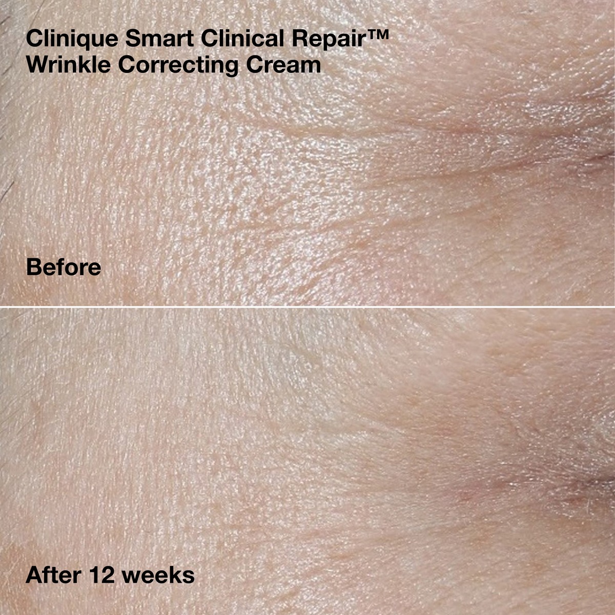 Clinique - Wrinkle-Correcting Routine Set - Image 3