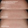 Clinique - Wrinkle-Correcting Routine Set - Thumbnail Image 4