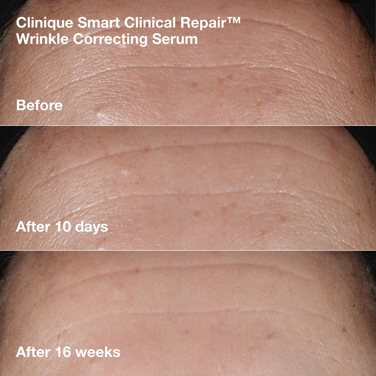 Clinique - Wrinkle-Correcting Routine Set - Image 4